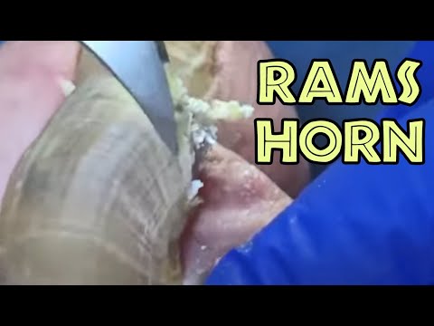Ram's Horn vs Big Fungal Nail 1