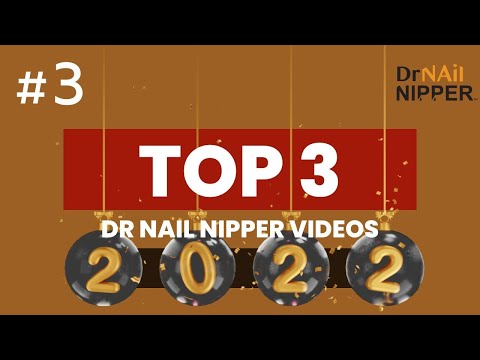 Best of 2022 Dr Nail Nipper Videos #3 - Old Nail on Top of New Toenail 1