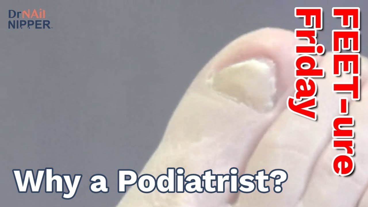 ➡️ Big thick toenail and why Dr Sperling got into podiatry 1