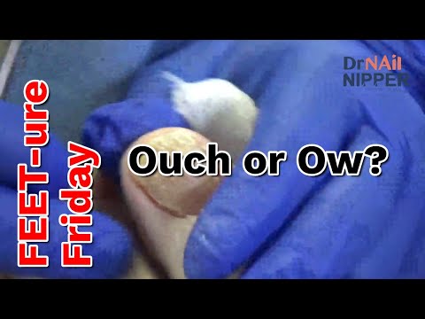 Patient Says Ow or Ouch. Rhymes with Couch (2023) 1