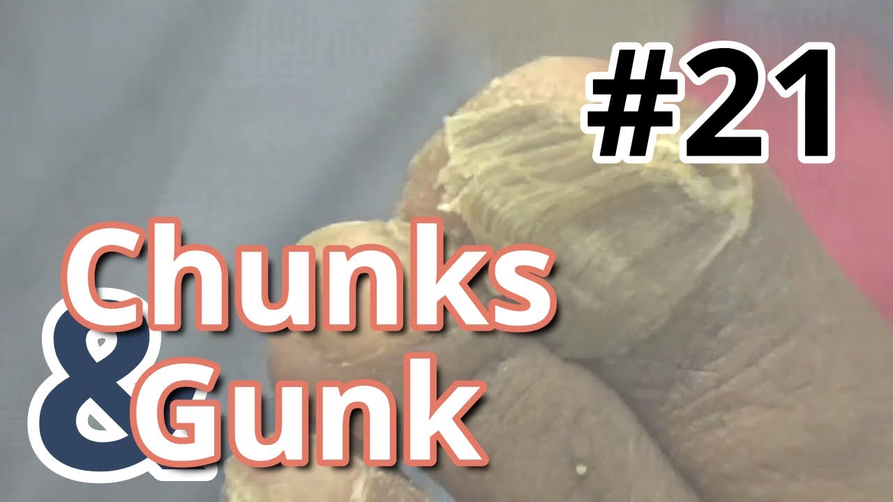 Chunks and Gunk #21 Another Big Toe Edition (2023) 1