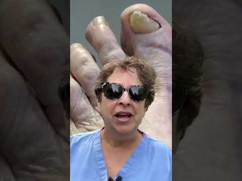 Just the Big Toes and Little Toes - Intro 1