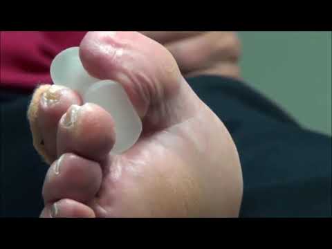 Dr. Nail Nipper's Callus and Pads! All Star Doctors Exclusive 1
