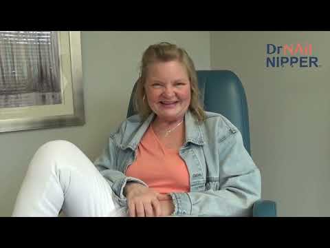 Left Ankle Abcess Diabetic Patient (2023) 1