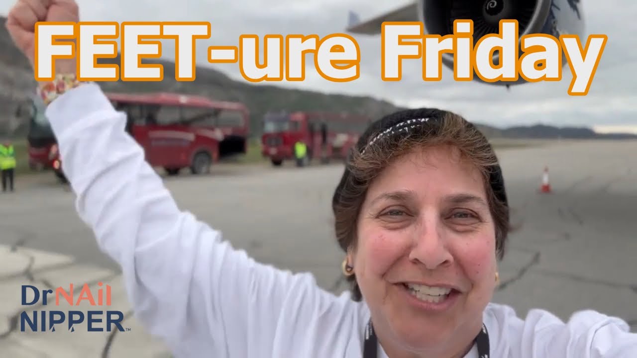 FEET-ure Friday (2023) 1