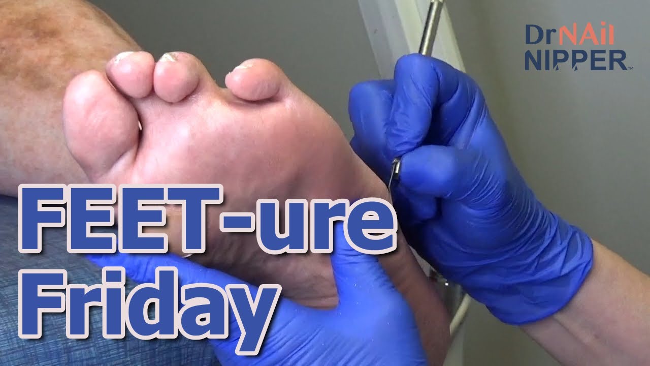 FEET-ure Friday (2023) 1