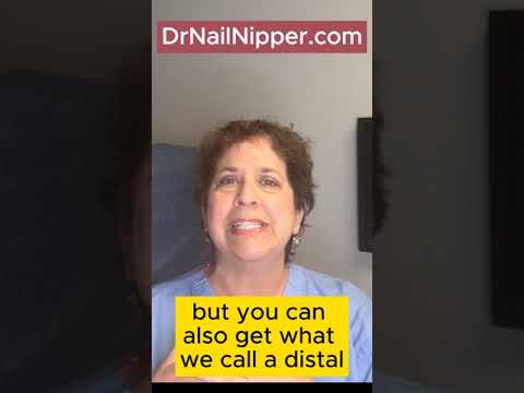 Cold Feet, Warm Toenails #drnailnipper #feet #toenail #weather #cold #warm 5