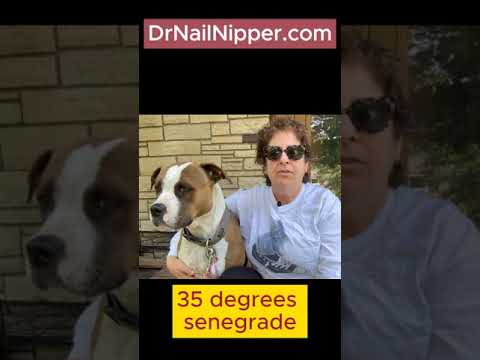 Toenails and Talking About Weather #drnailnipper #fungaltoenail #toenailfungus #weather 1