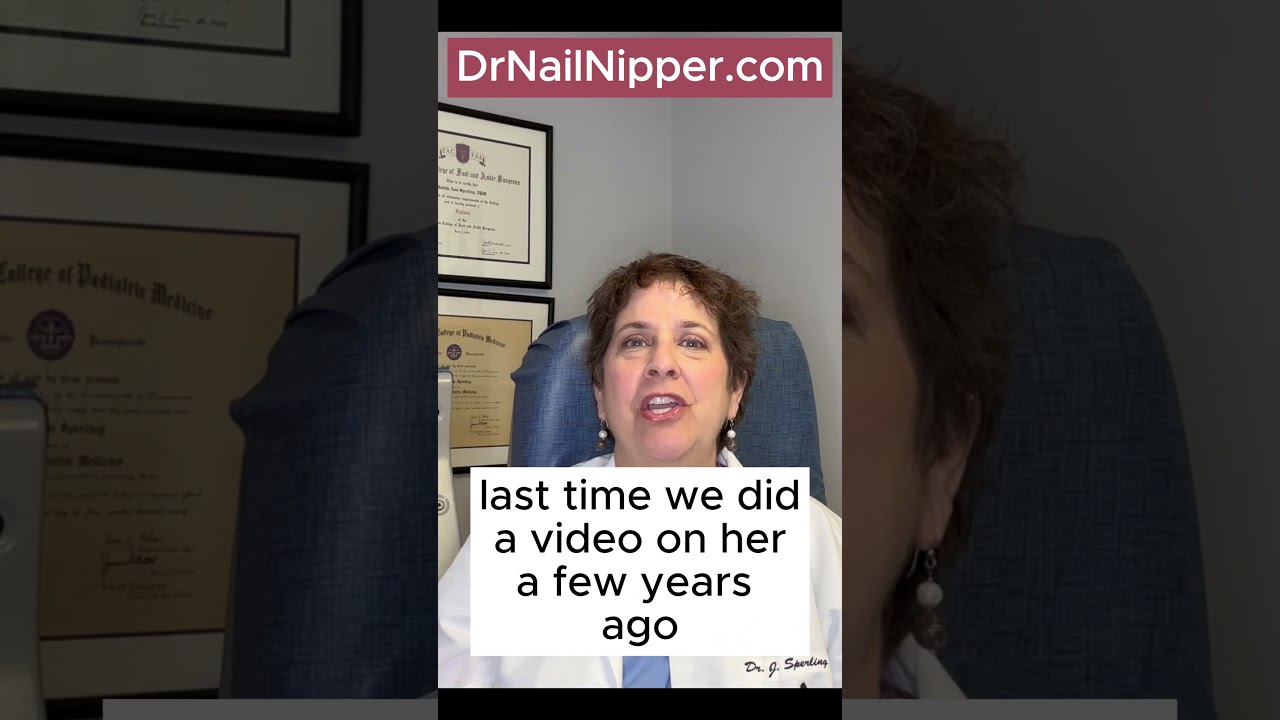 Dr Nail Nipper ➡️ Depression and Our Feet Part 2 #foothealth #nailnipper #drnailnipper #depression 6