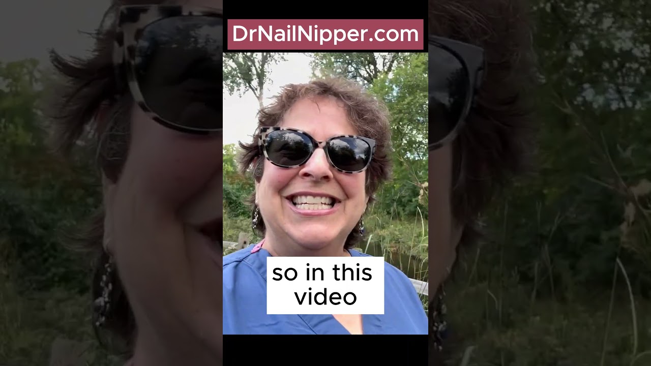 Dr Nail Nipper ➡️ Great Big Ram's Horn Nails on Big Toes #RamsHornToenails #RamsHorn #toenails 5