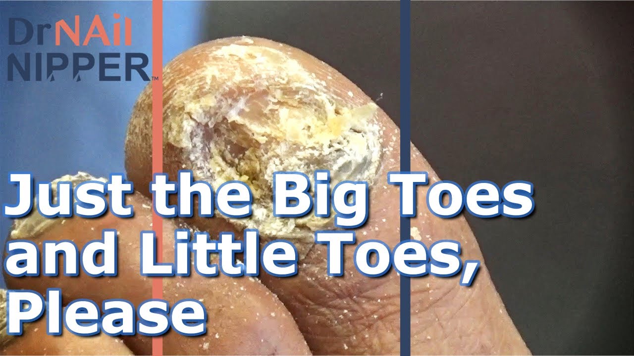 Chunks & Gunk #24 - Just the Big Toes and Little Toes, Please. FEETure Friday (2023) 4