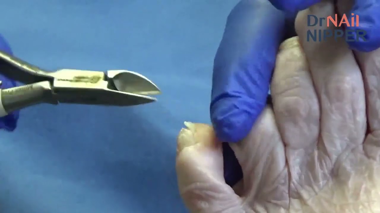 Dr Nail Nipper Short for February 23 Dr Nail Nipper