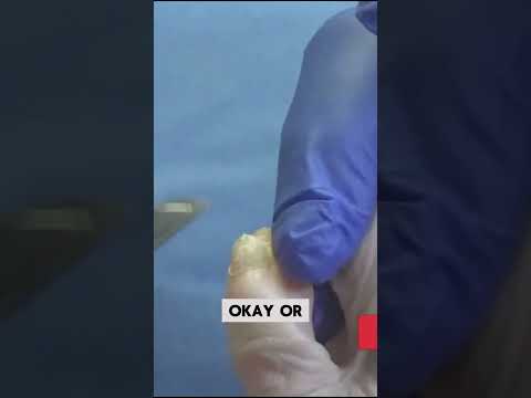 FEETure Friday Shorts February 23 #footcare #foothealth #drnailnipper #podiatrycare 1