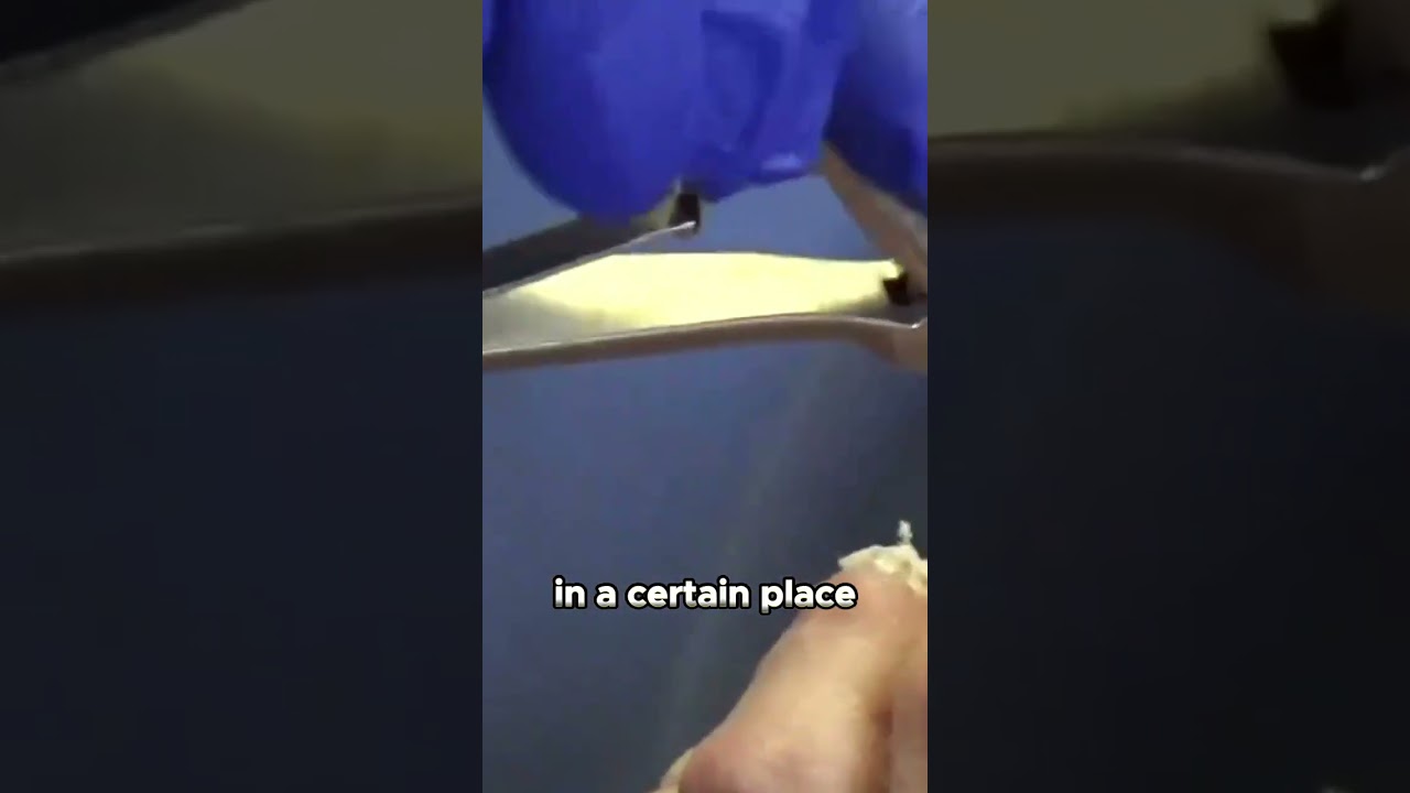 Debunking Fears Fungus and the Bloodstream #fungus #toenails 1