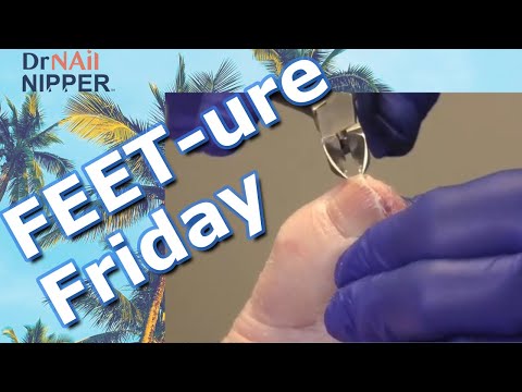FEET-ure Friday (2024) ???????? #bigtoenails #drnailnipper 1