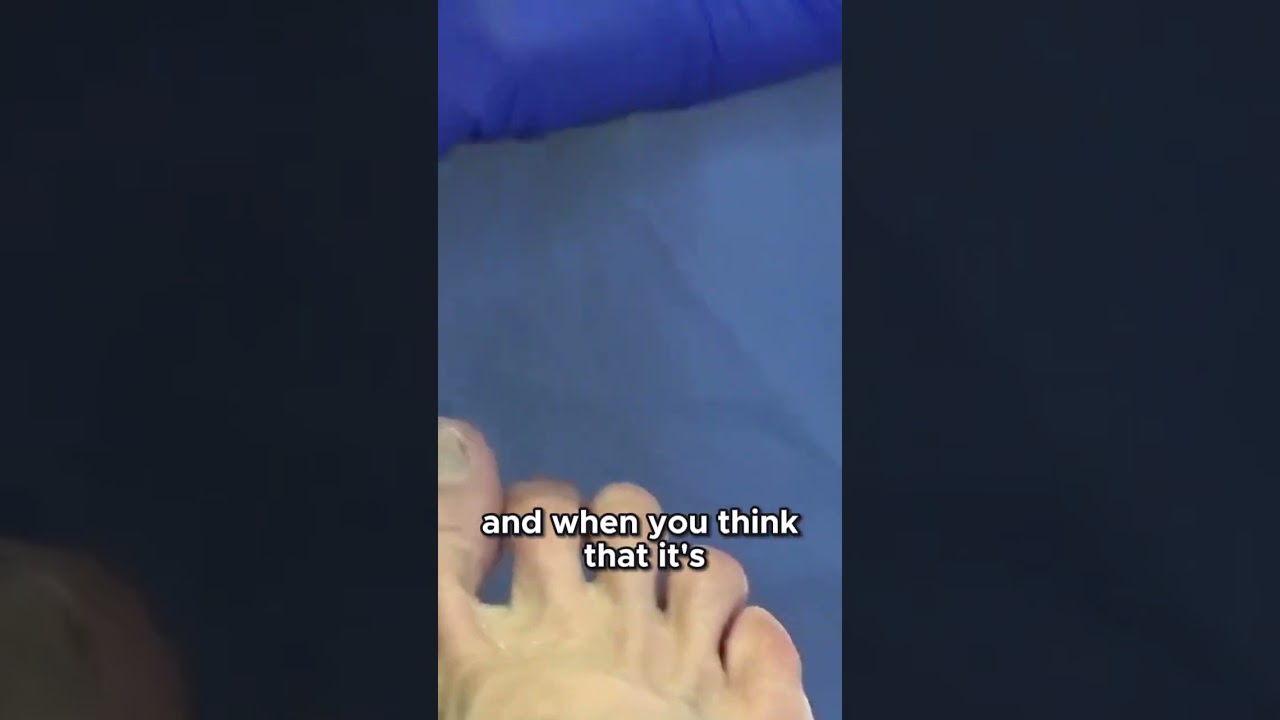 Nail Check-up Progress and Future Plans #drnailnipper #toenails 1