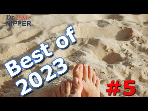 Best of 2023 - #5 | FEET-ure Friday (2024) ???????? #longtoenails #bigtoenails #drnailnipper 1