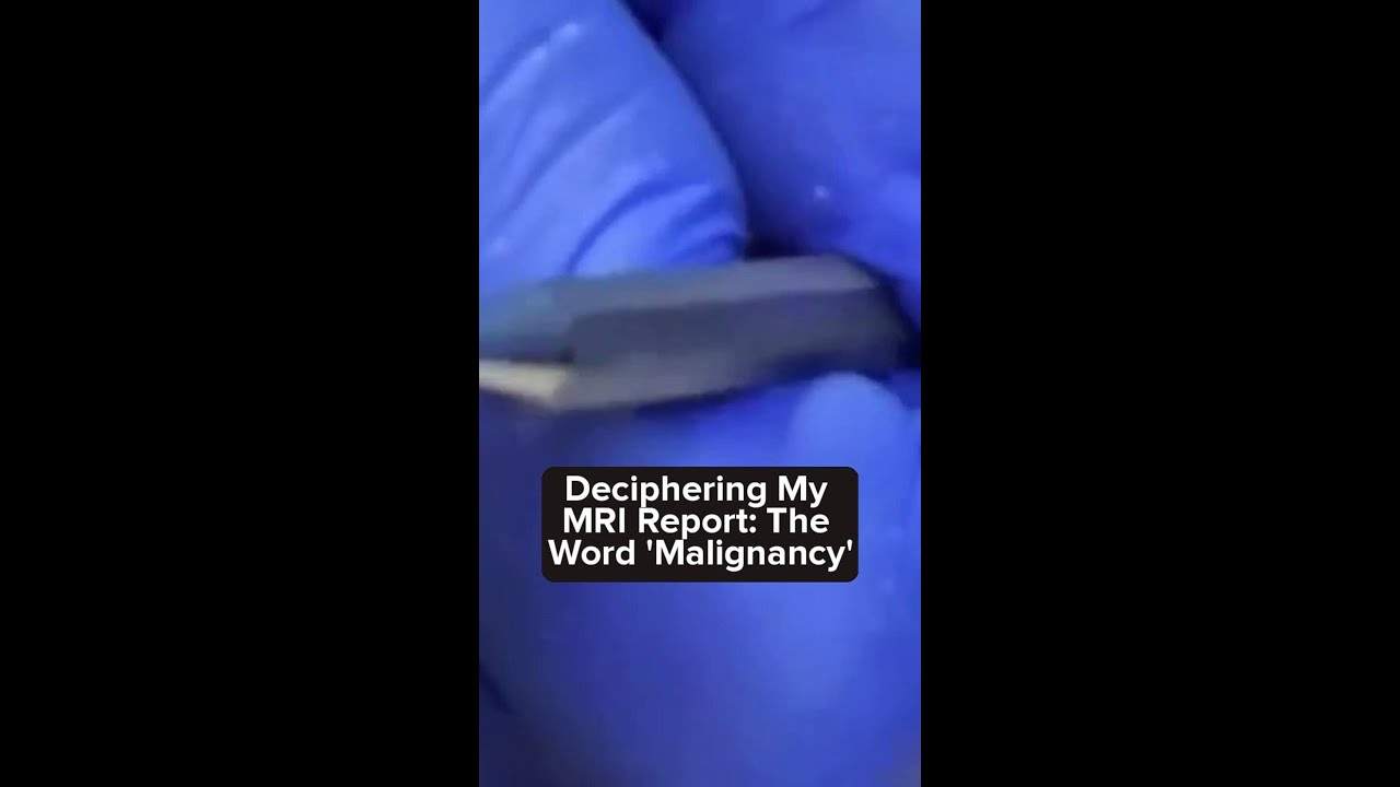 Deciphering My MRI Report The Word #MRIReport #mulligan 1