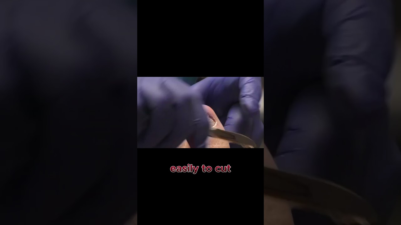 A New Nail Growing Underneath Here's What Your 1