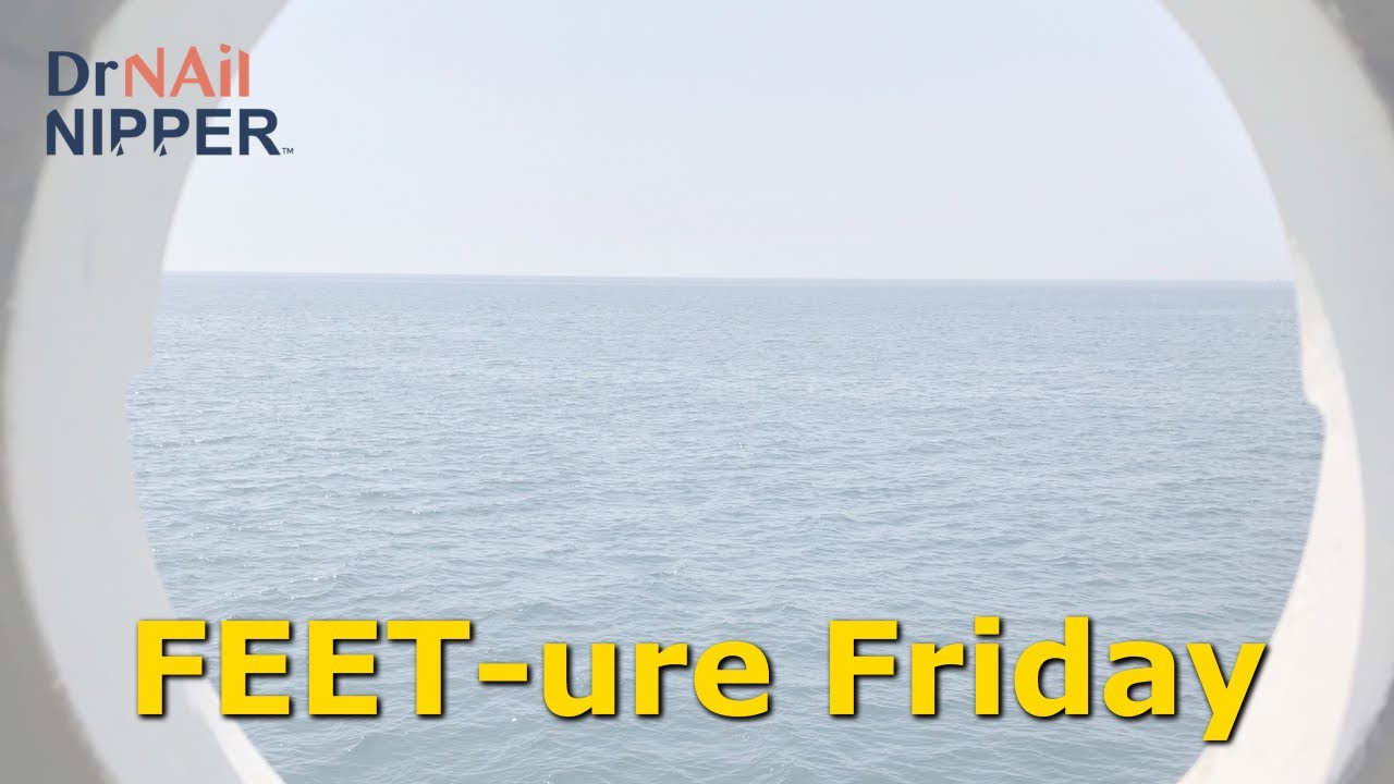 FEET-ure Friday | The Bigger Callus was Less Painful 👩🏻‍⚕️🦶👣🦵🚶🏃 1