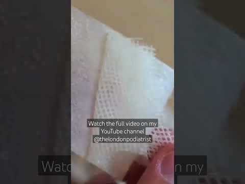 Jelonet is a non adherent wound dressing. 1