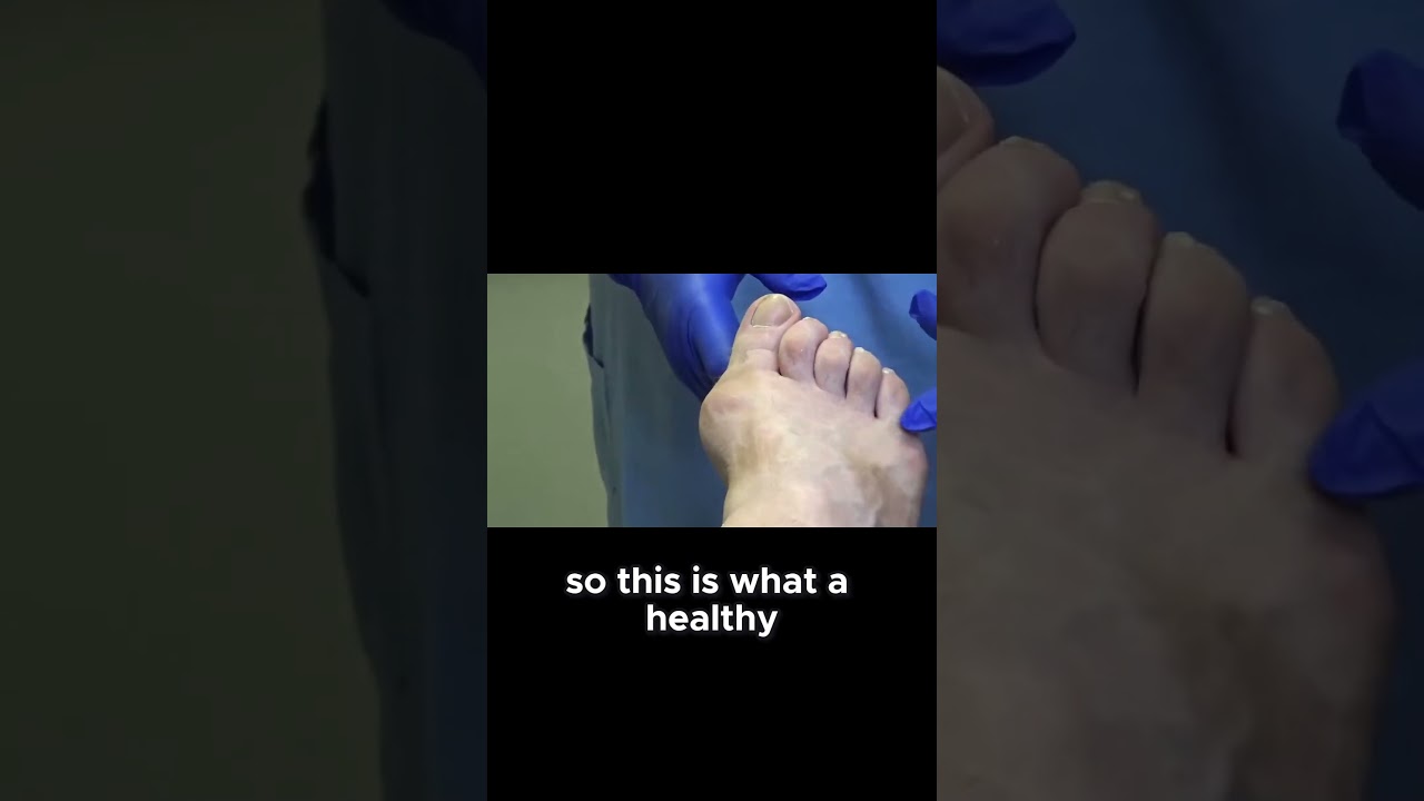 What Your Toe Hair Says About Your Health 1