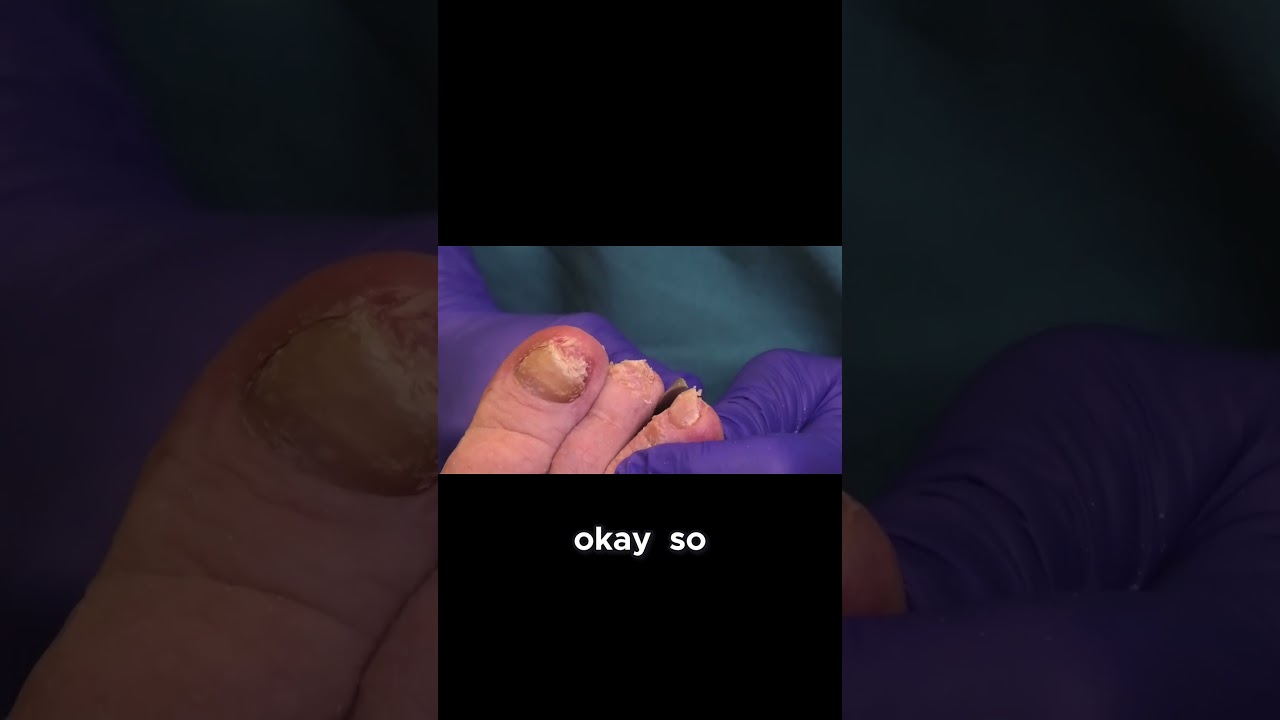 Music Therapy Banjo Tunes During Medical Procedure 1