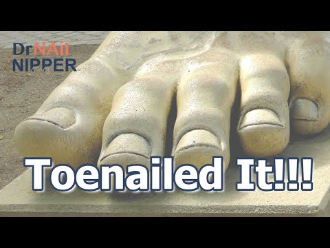 Toenailed it!!! | FEET-ure Friday - Dr Nail Nipper (2024) 1