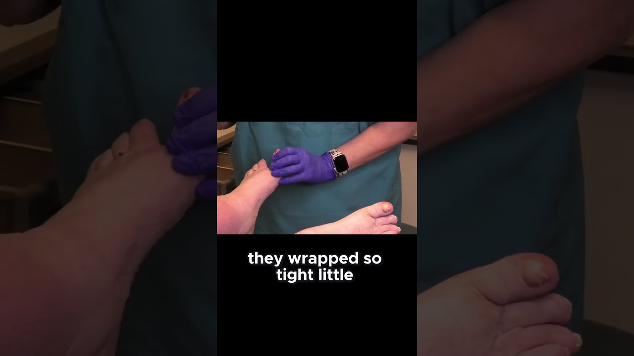 The Importance of Consistent Lymphedema Care 1