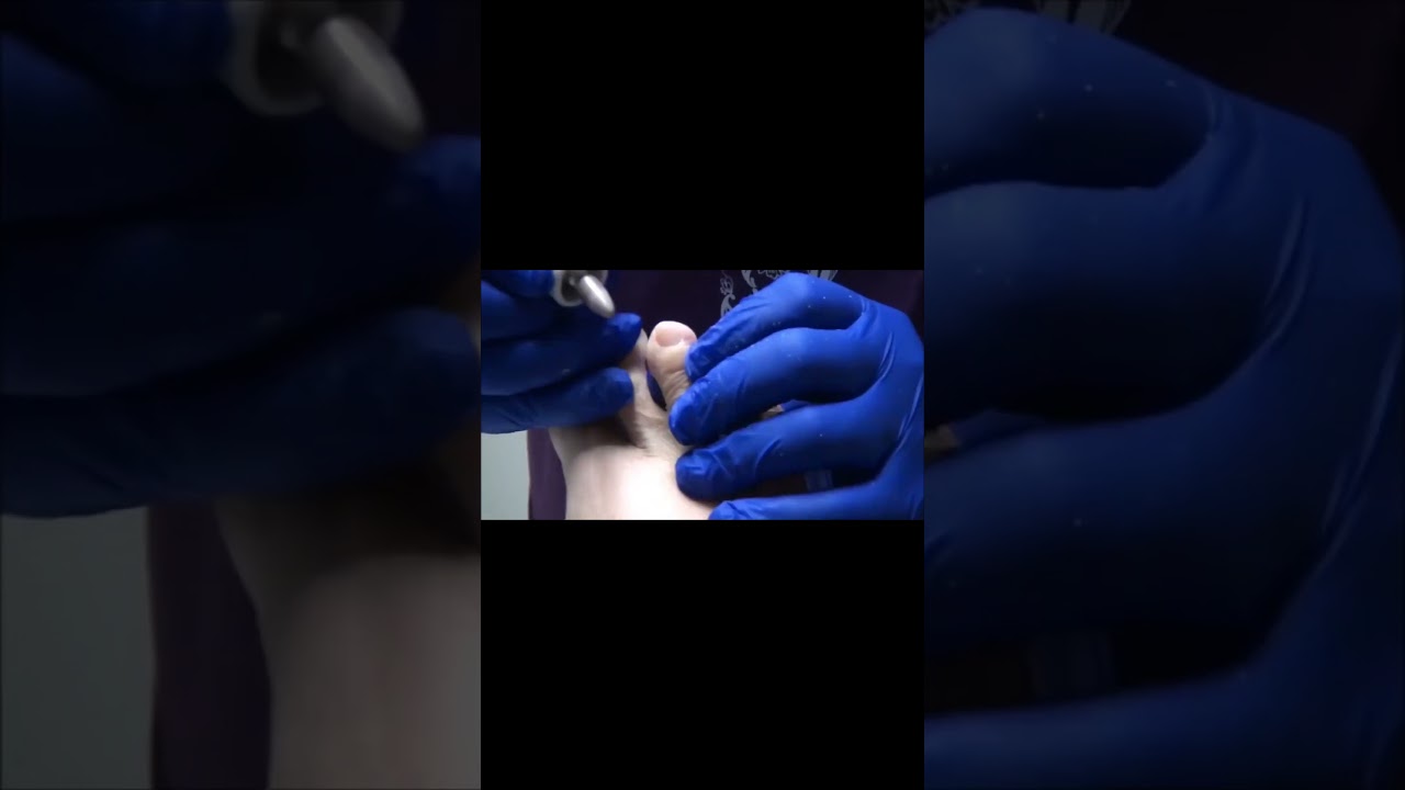Watch restless leg syndrome, pedicure ticklish! #RestlessLegSyndrome #PedicureProblems #TicklishFeet 2