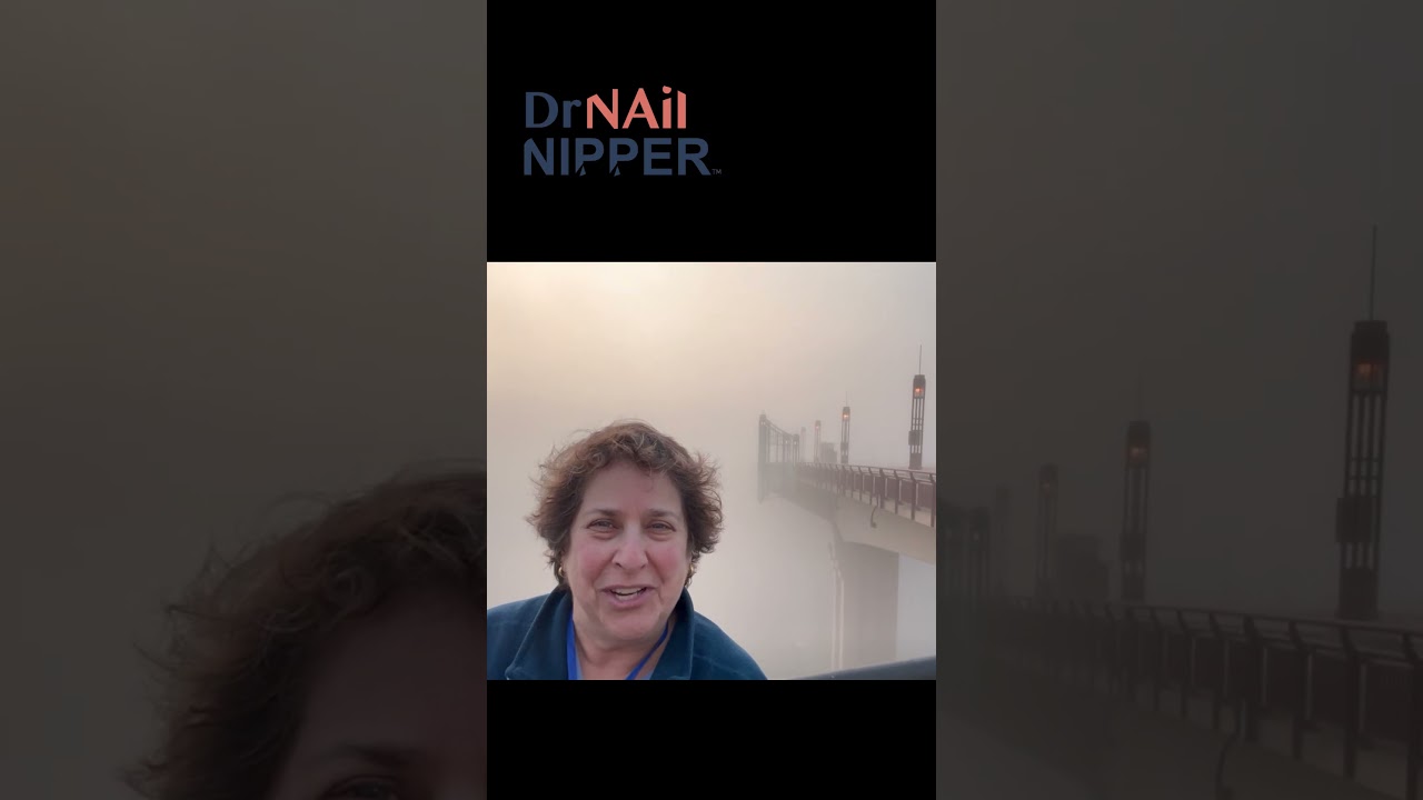 Dr Nail Nipper in St Paul along the Mississippi River #drnailnipper #foothealth #footcare 4
