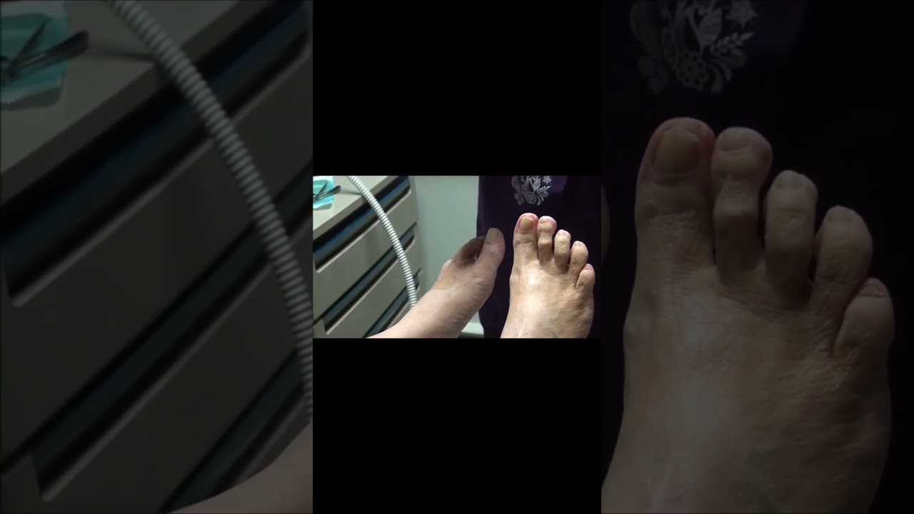 Did you know clipping toenails can make you lighter? #ToenailClipping #WeightLossSecret 3