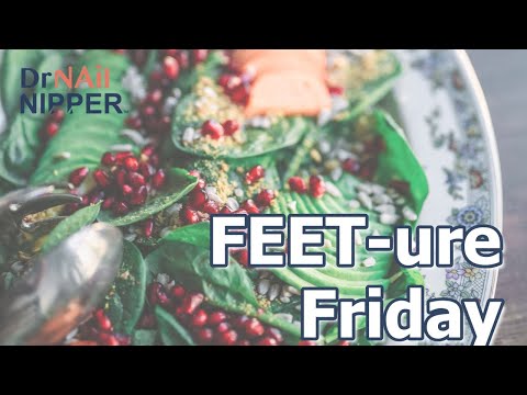 Type 2 Diabetes Foot Care Patient | FEET-ure Friday - Dr Nail Nipper (2024) 1