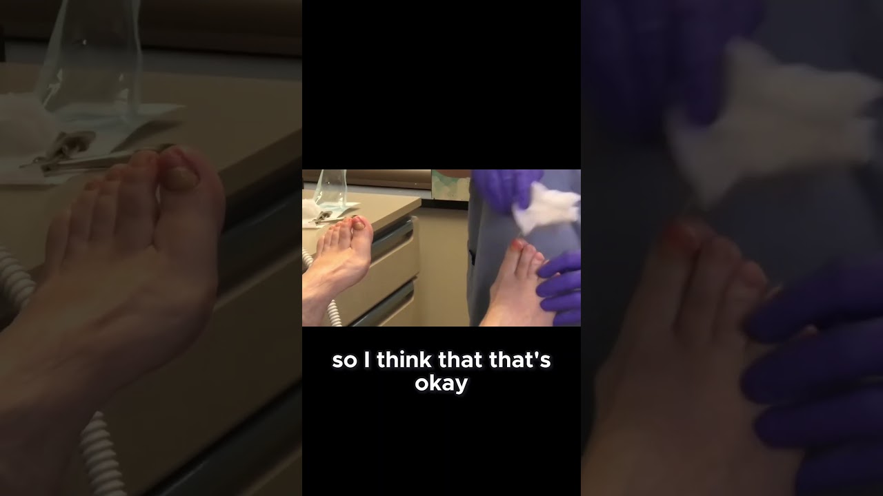 Great news for your big toe! Find out how to keep it healthy. #BigToeHealth #FootCare #HealthyFeet 3