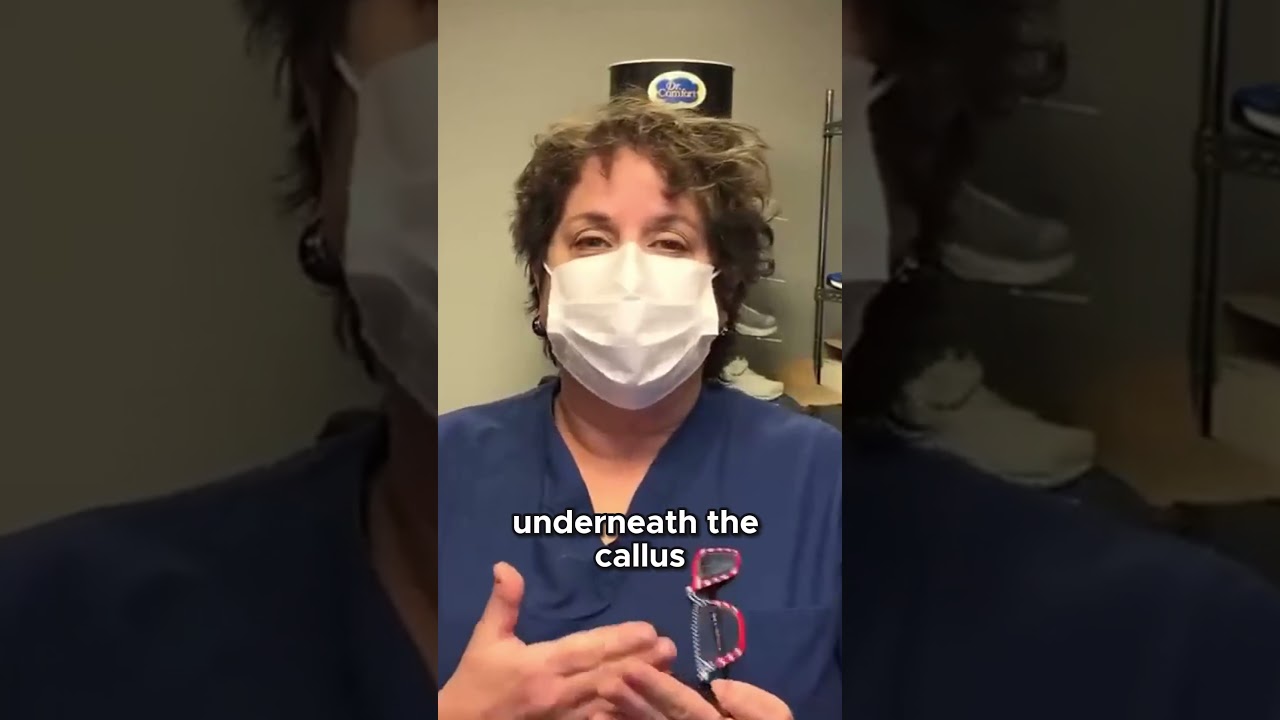 Unusual Callus Mystery What Could Have Cause #MedicalMystery #Callus #UnexpectedFind 5