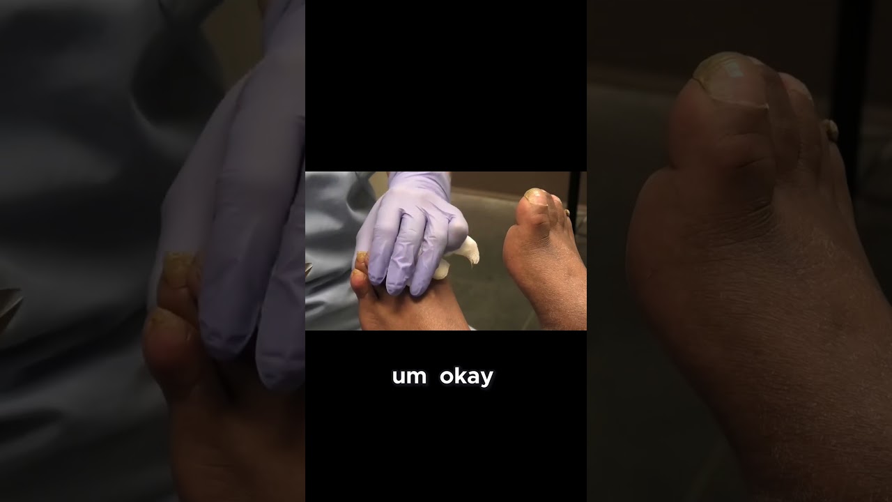 Discover the meticulous process behind preparing food for a major event! #footcare #drnailnipper 1 Discover the meticulous process behind preparing food for a major event! #footcare #drnailnipper 1