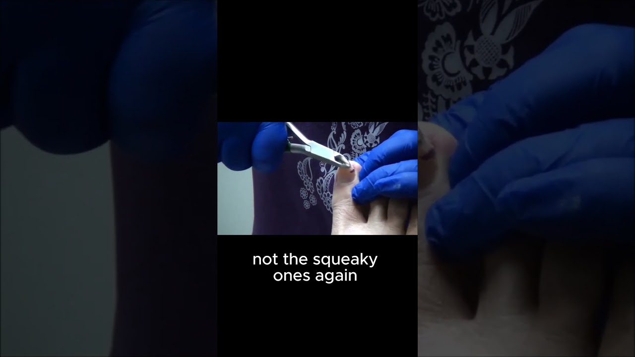 The Squeaky Toenail Fix! #drnailnipper #toenailcare #squeaky #nailclippers 5