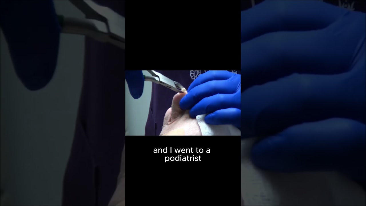 The Shocking Truth About My Dead Toe 3