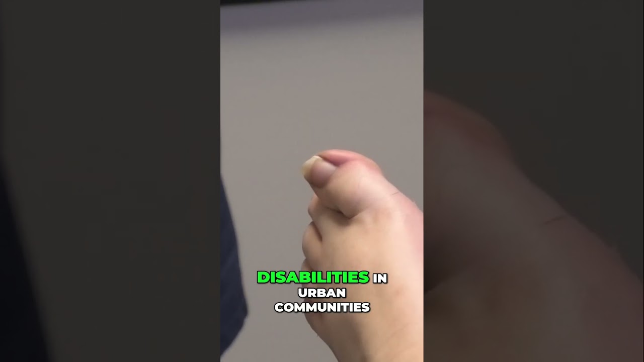 Navigating Double Master's - Leadership in Disability Advocacy #leadership #disabilityadvocacy 1