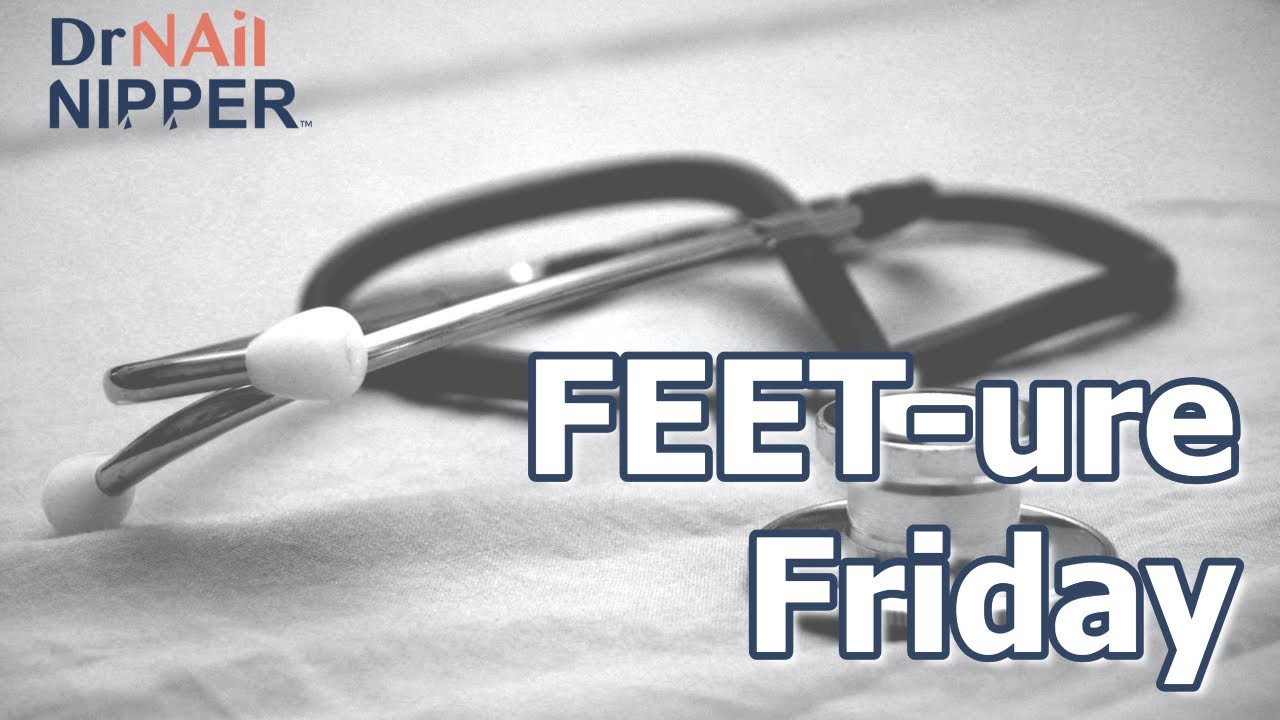 Ehlers-Danlos syndrome (EDS) and Toenail Care | FEET-ure Friday - Dr Nail Nipper (2024) 6
