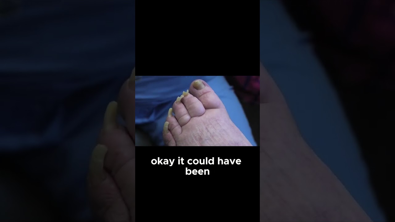How Long Since Your Last Toenail Trim #longnails #nailcare 1