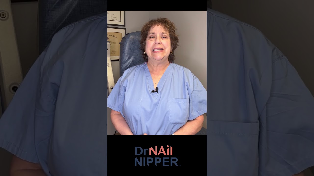 Ehlers-Danlos syndrome (EDS) and Toenail Care #footcare #foothealth #drnailnipper #podiatry 2
