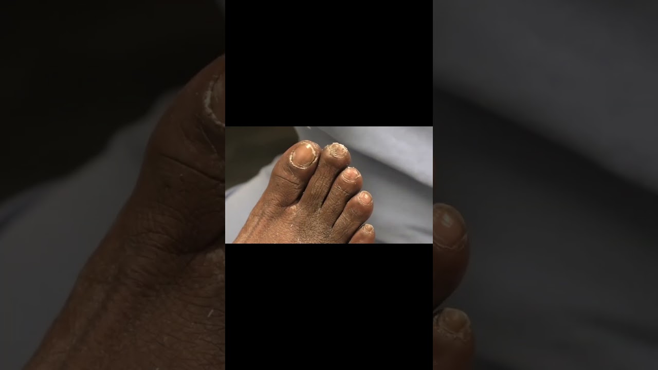 The One Foot Down Record A Funny Start! 1