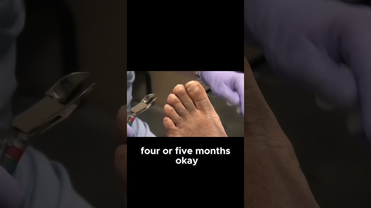 Pampering at the Mall A Foot Care Story 1