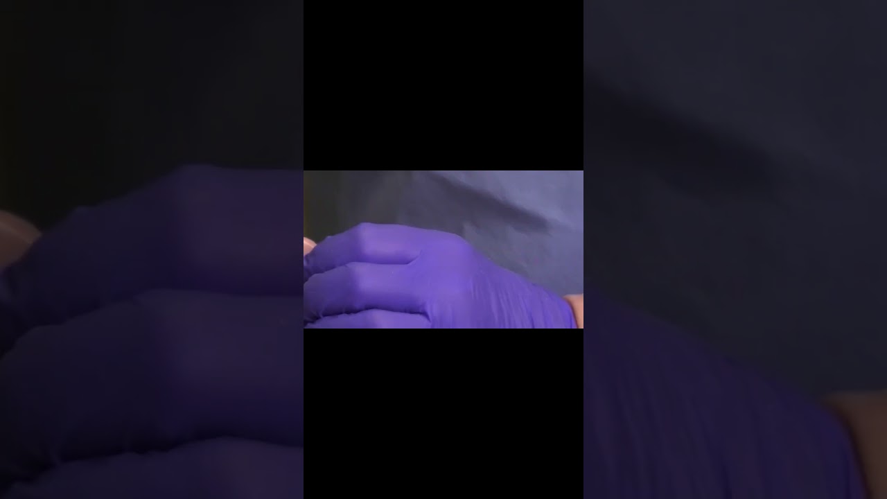 Managing Damaged Nails What You Need to Know #NailHealth #FootCare #NailManagement 1