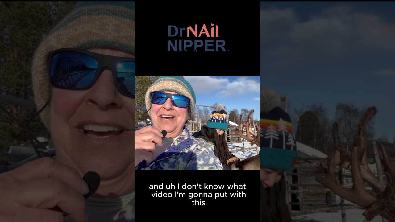 Dr Nail Nipper in Norway and Sweden with the Reindeer #drnailnipper #footcare #podiatry 1