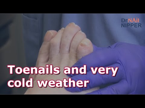 Toenails and very cold weather #drnailnipper #footcare #foothealth #toenailcare 1