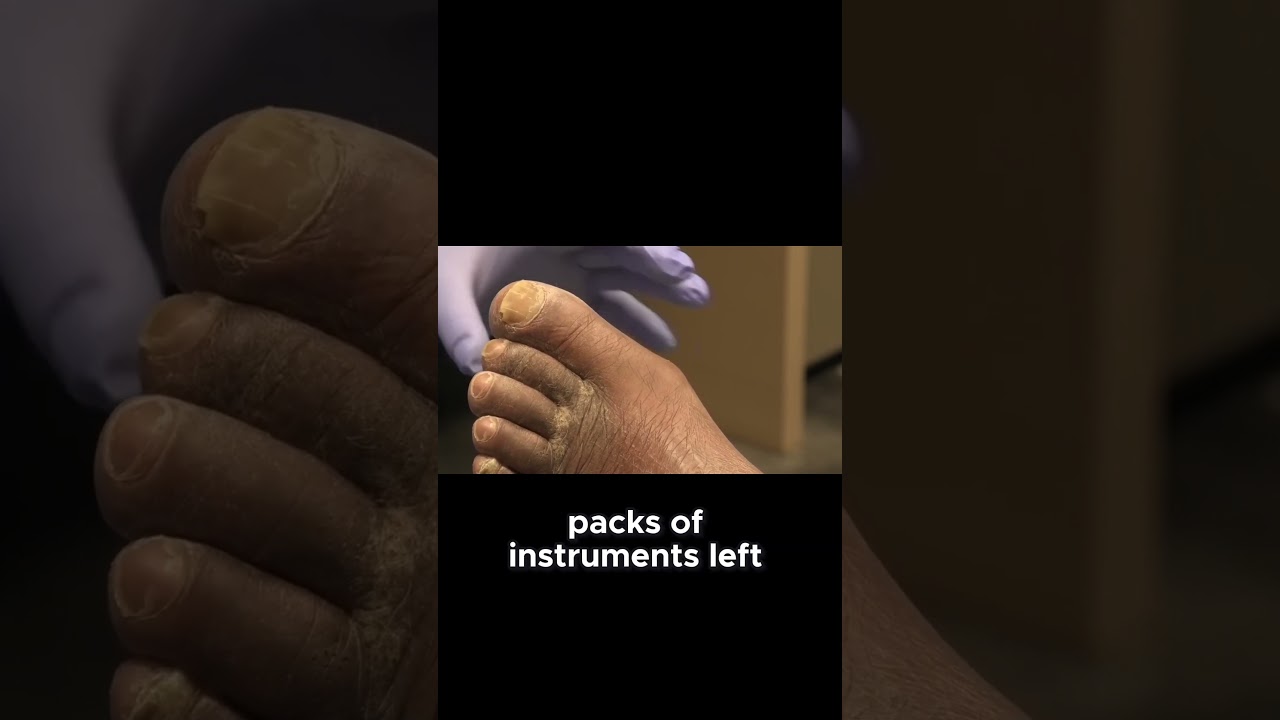 Trimming Toenails Tips and Tricks! #ToenailCare #FootHealth #selfcaretips 1