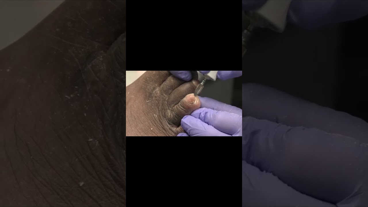 Meet the Foot Doctor Thousands of Happy Feet #FootDoctor #HealthyFeet #MedicalAdvice 1