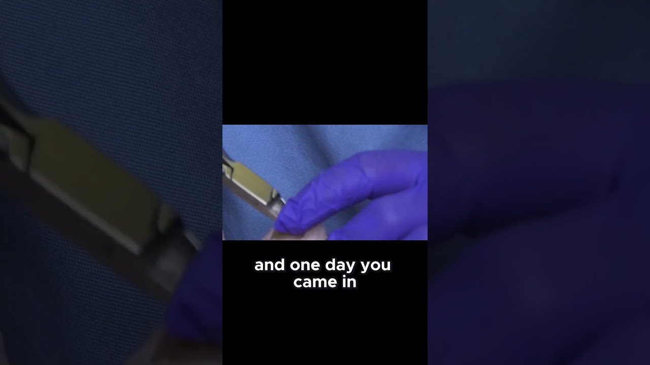 Miracle Patient Overcoming Warts Against All Odds 1